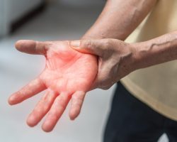 Peripheral Neuropathy pain, Guillain-Barre Syndrome GBS in elderly aged old patient on hand, fingers, sensory nerves with numb, muscle weakness, chronic inflammatory demyelinating polyneuropathy